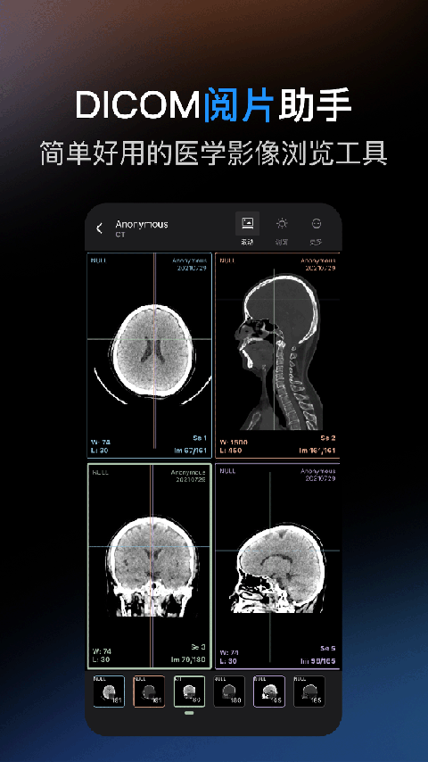 影像解剖图谱app