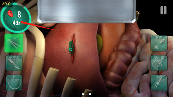 医院手术时间官方版