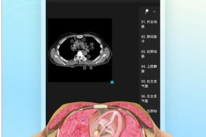 维萨里3d解剖app