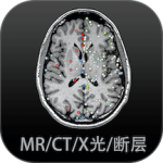 影像解剖图谱app