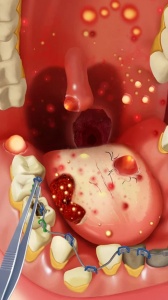 疯狂的诊所国际服(Happy Hospital)