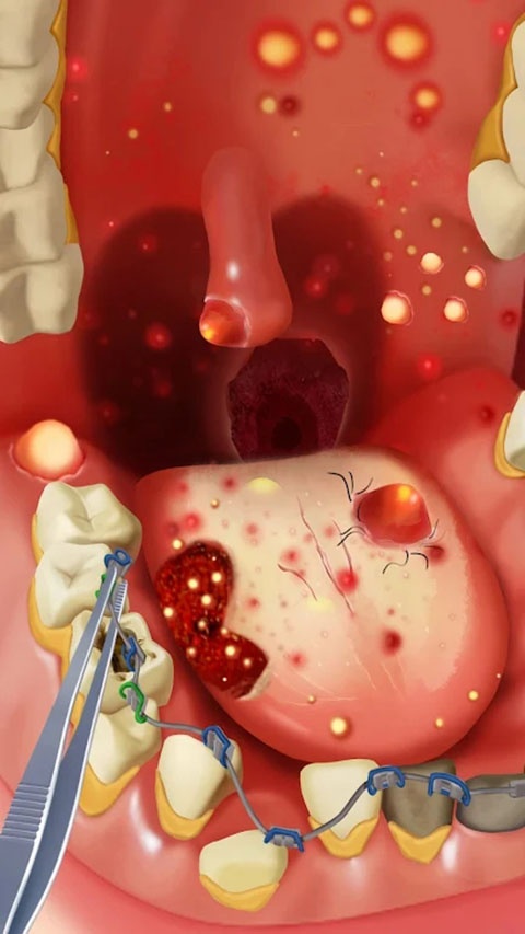 疯狂的诊所国际服(Happy Hospital)