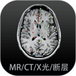 影像解剖图谱app
