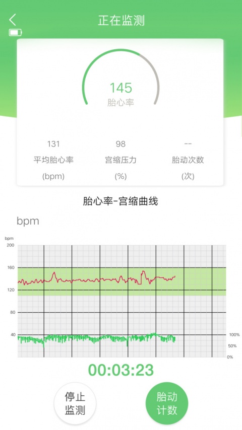 喜芽胎心监护仪