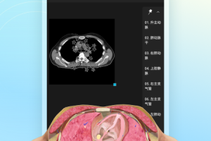 维萨里3d解剖app