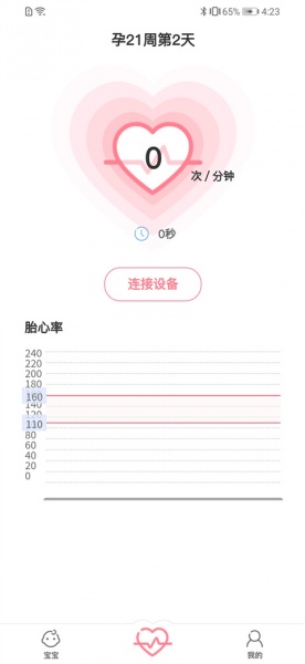 fetalheart胎心仪官方版