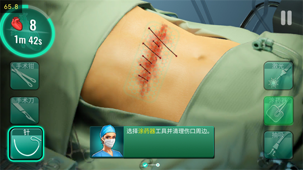 医院手术时间官方版
